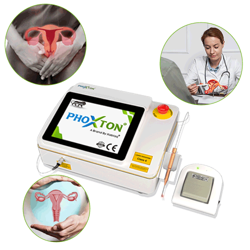 Gynecology Laser Machine Manufacturers